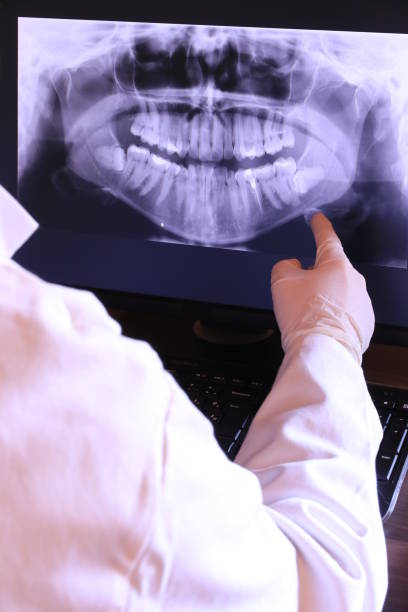 Best Chipped Tooth Repair Near Me  in East Falmouth, MA