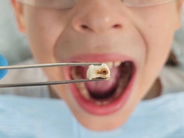 Best Dentist for Dental Trauma  in East Falmouth, MA